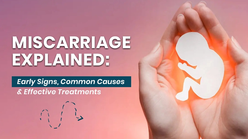 Understanding Miscarriage: Symptoms, Causes & Treatment Service